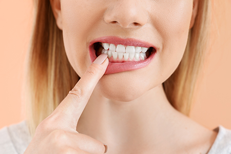 Hewlett Dental Excellence