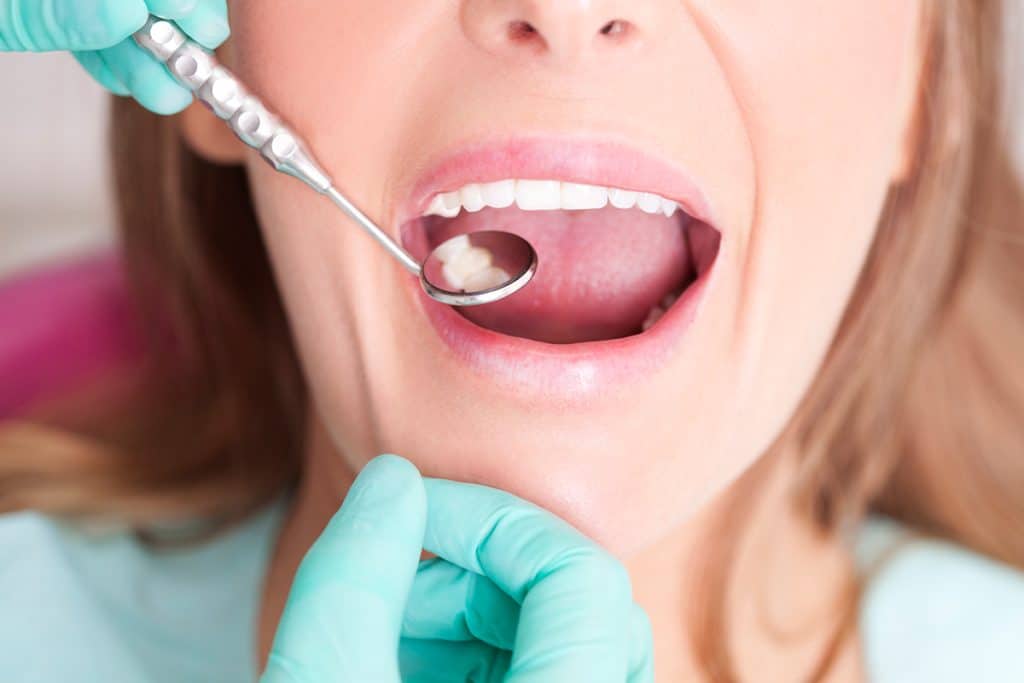What to Do When a Dental Filling Falls Out: Emergency Steps & Next Moves
